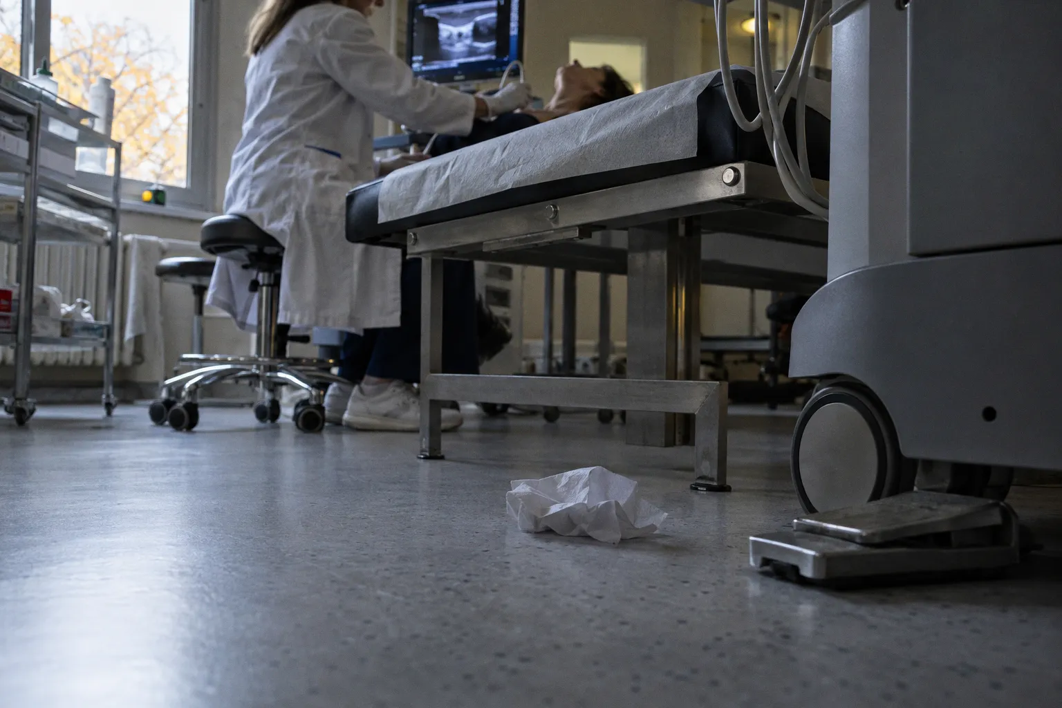 Stenosi carotidea: criteri Doppler per la valutazione emodinamica